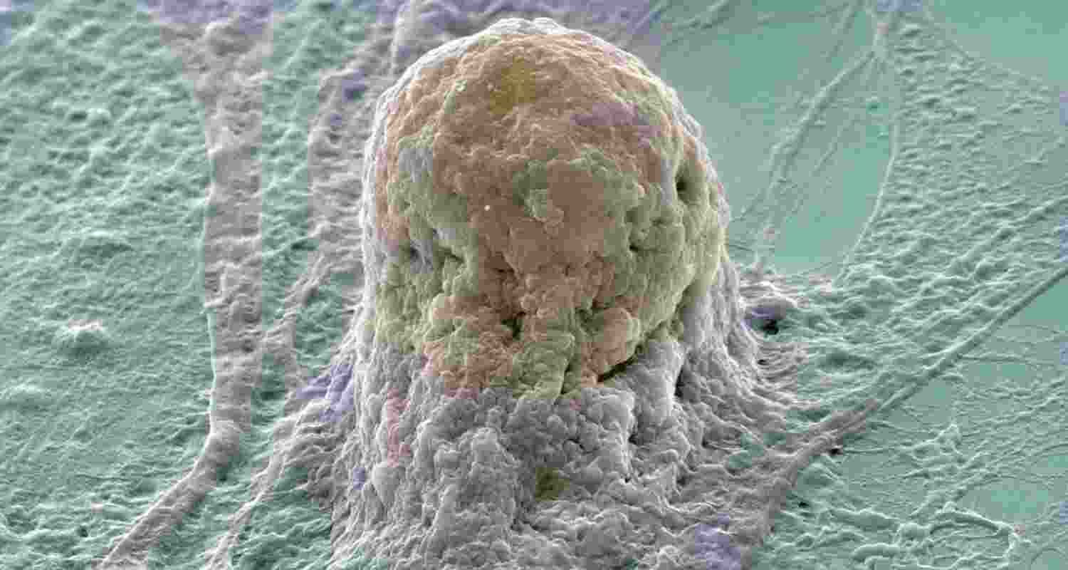 Stem cells: The future of diabetes care Stem cells: The future of diabetes care