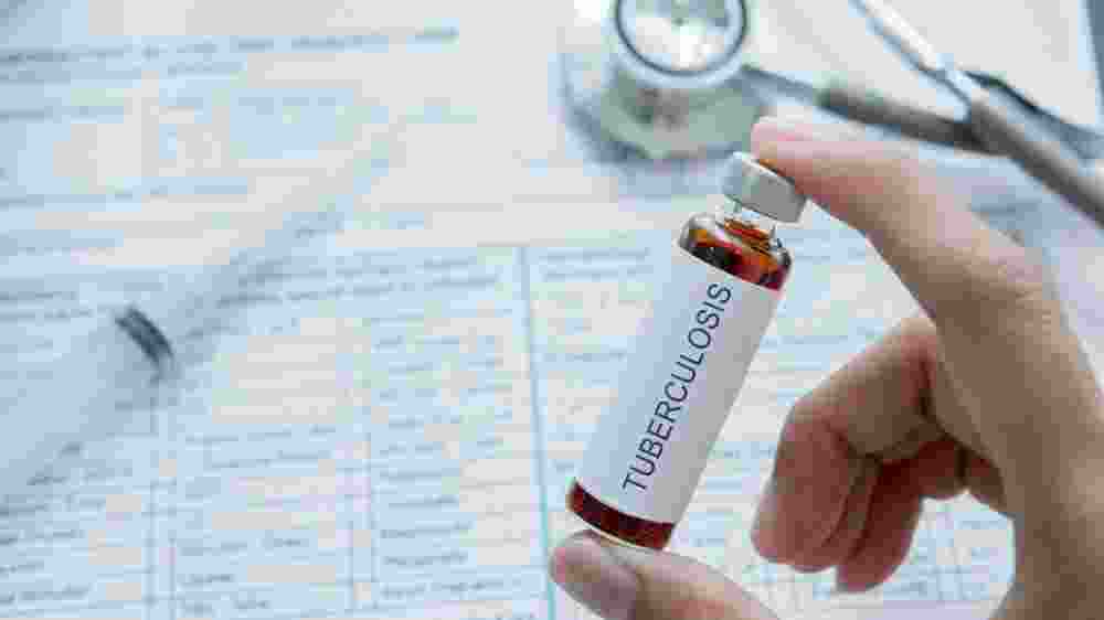 Health ministry approves new MDR-TB treatment Health ministry approves new MDR-TB treatment