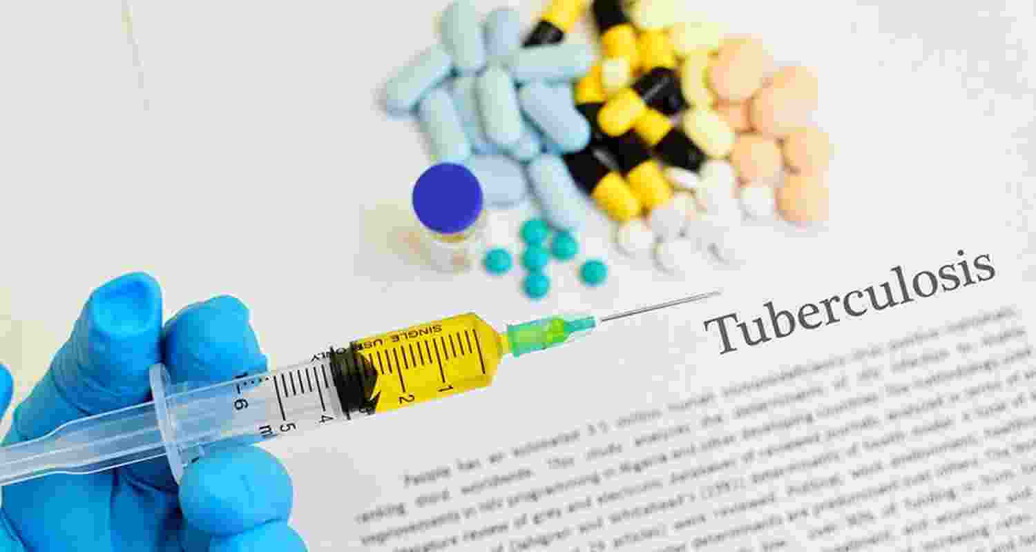 In a first, Tamil Nadu to implement TB death prediction model In a first, Tamil Nadu to implement TB death prediction model