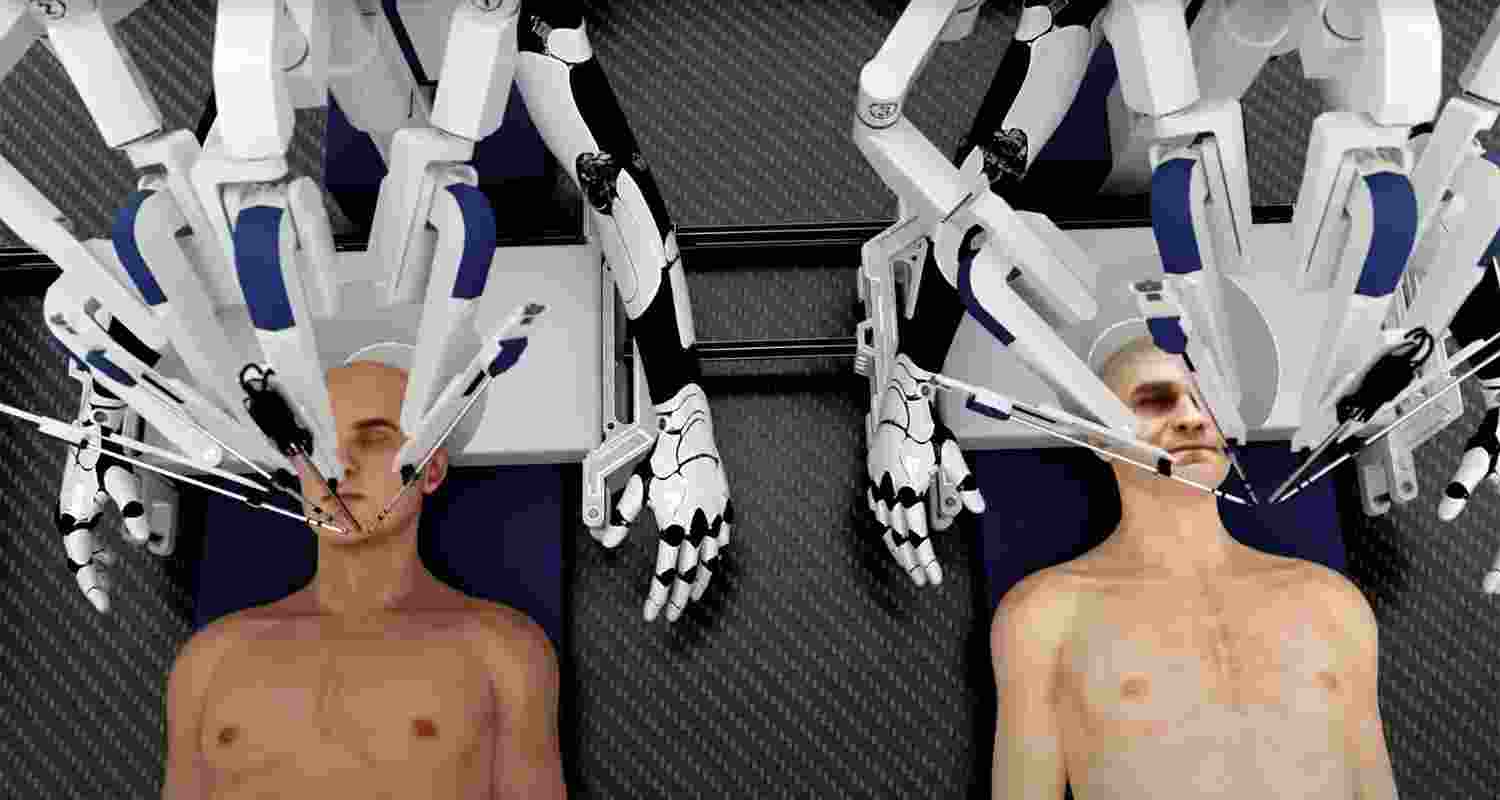 Utilising advanced robotics and real-time molecular imaging, the process entails simultaneous head removal of donor and recipient, seamlessly transferring the recipient's head to the donor's body. Utilising advanced robotics and real-time molecular imaging, the process entails simultaneous head removal of donor and recipient, seamlessly transferring the recipient's head to the donor's body.