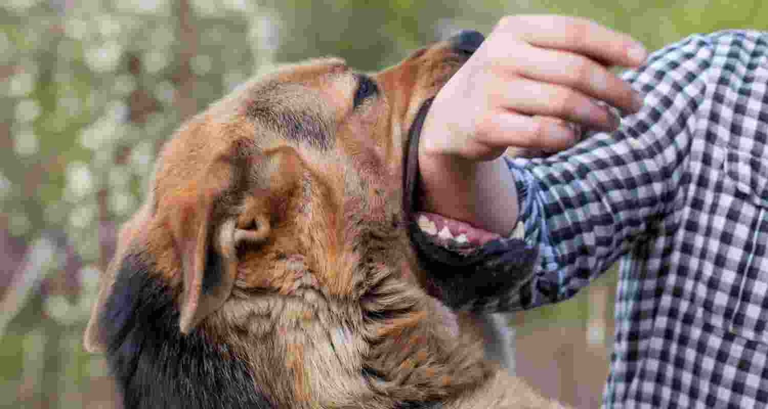 Representative Image of a dog bite.  Representative Image of a dog bite.