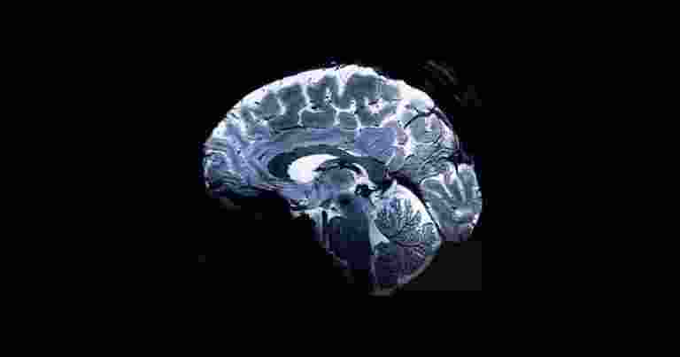 The world's most powerful MRI scanner has unveiled the first-ever images of the human brain, promising unprecedented insights into its complexities and associated afflictions.  The world's most powerful MRI scanner has unveiled the first-ever images of the human brain, promising unprecedented insights into its complexities and associated afflictions.
