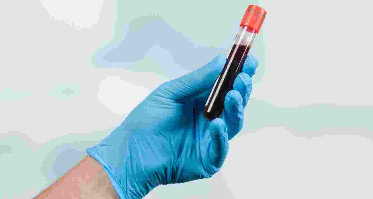 New AI tool refines blood test norms for patients New AI tool refines blood test norms for patients