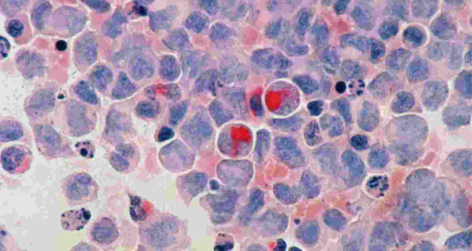 Dying cancer cells can be dangerous. Dying cancer cells can be dangerous.