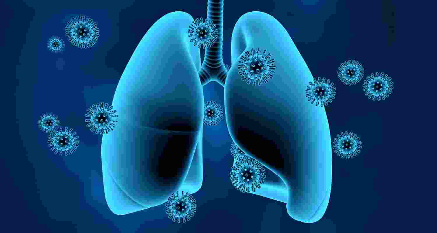 Long COVID inflicts deep scars on the lungs: Study Long COVID inflicts deep scars on the lungs: Study