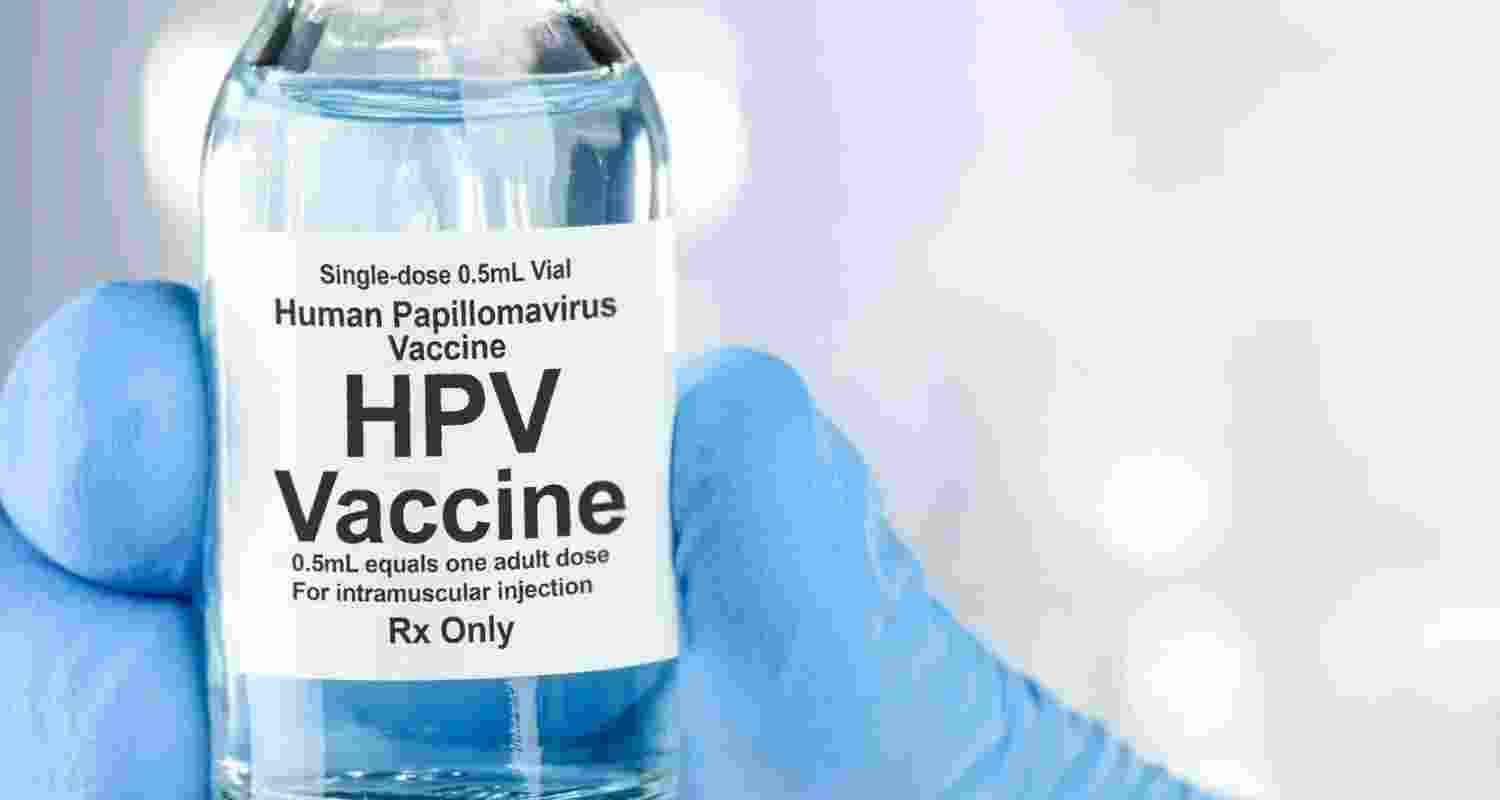 Representational image. Representational image.